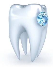 Diamond a fogat - az értékes mosoly - mintegy harapás korrekciója és fogszabályozó