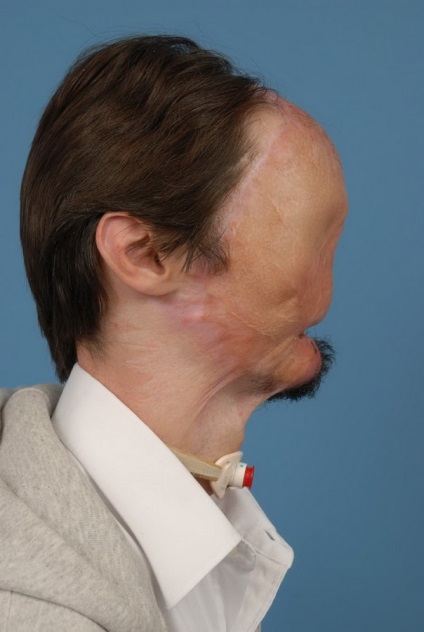 Man Without a Face - hírek képekben