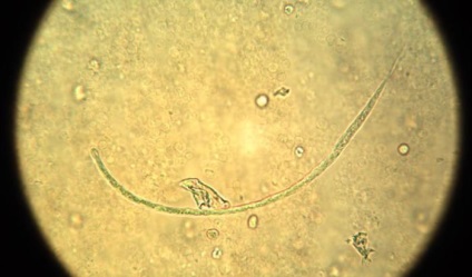 Worms az emberi szív (szív) Worms szívében egy férfi