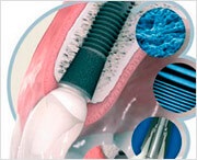 Straumann implantátumok betegtájékoztatás (Straumann implantátum) Straumann implantátumok betegtájékoztatás