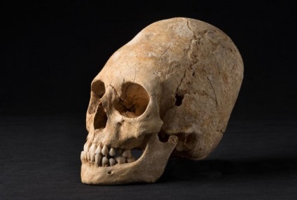 Érdekes tények az emberi koponya