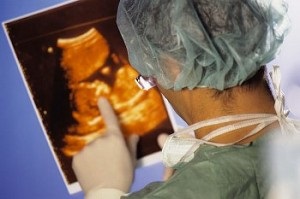 A komputertomográfia (CT) a terhesség