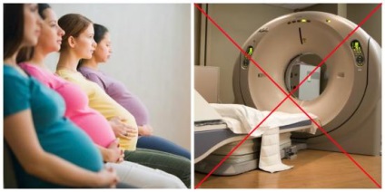 CT terhesség, ha lehetséges, milyen hatással