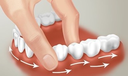 Masszázs a fogíny periodontitis, periodontiíissei mint a do