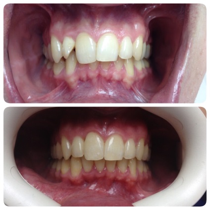 Ortopédiai stomatology (fogászat) Tanszék Ortopédiai Dentistry