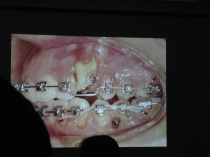 Tanszék Ortopédiai Dentistry