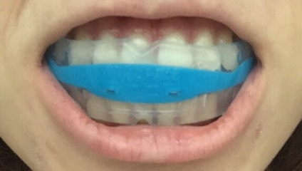 Ortopédiai fogászat (Department) Tanszék Ortopédiai Dentistry