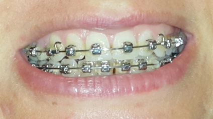 Tanszék Ortopédiai Dentistry (tej őrlőfogak) Tanszék Ortopédiai Dentistry