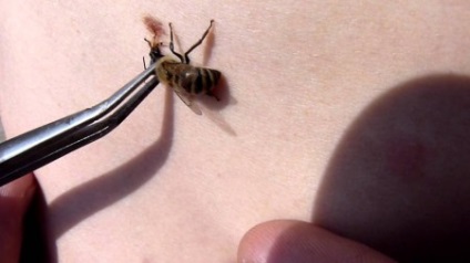 Méhméreg ezért az orvostudomány és hogyan kell alkalmazni