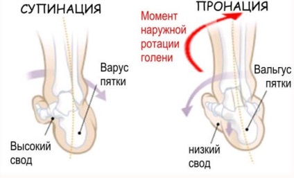 Plano-valgus láb a gyermek és a felnőtt forma okait, a kezelés (gyerek) Plano-valgus láb a gyermek és a felnőtt forma okait, a kezelés