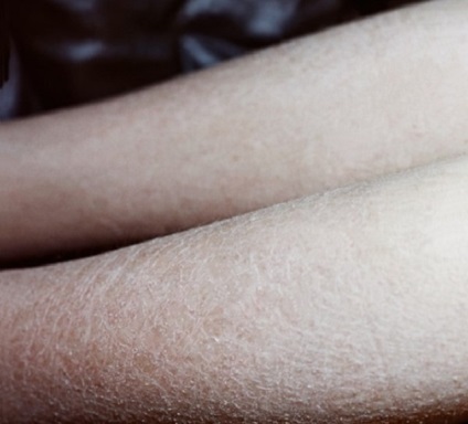 Чому сверблять ноги після гоління що робити