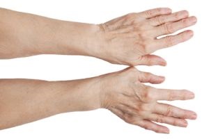 Okai és az izületi gyulladások kezelésére kezek - tünetek és patológia fotó