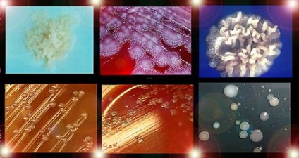 Jelek a kolóniák mikroorganizmusok - studopediya