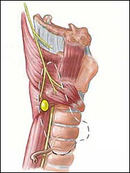 Pajzsmirigy - jellemzői az anatómiai szerkezet (helyét a pajzsmirigy,