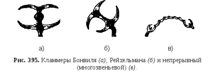 Stavropol Állami Orvosi Akadémia (betöltött periodontális támogatás) Stavropol Állami Orvosi Akadémia