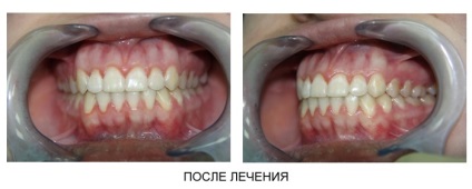 Fogászati klinika nizhgma ortopédiai osztály (ortopéd) Fogászati klinika nizhgma ortopédiai osztály