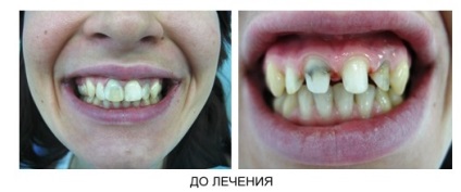 Fogászati klinika nizhgma ortopédiai osztály (osztás) Fogászati klinika nizhgma ortopédiai osztály