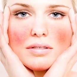 Allergia az arcon - allergiás reakciókat