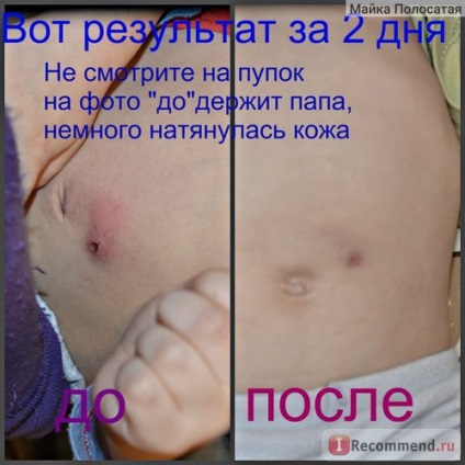 Fertőtlenítő balzsam Shostakovskiy (Vinylinum) - „kezelése stomatitis gyermekeknél