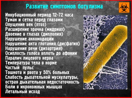 Botulinum toxin - azaz, az alkalmazás, a következmények a mérgezés (alkalmazás) Botulinum toxin - azaz a használat hatásait mérgezés