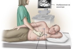 Mi a jobb ultrahang vagy EKG-szív