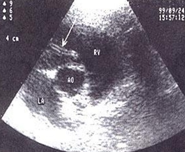 Dirofilariasis - jelenlegi útmutató macskáknak (dirofilariasis) Dirofilariasis - jelenlegi útmutató macskáknak