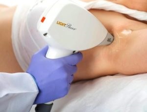 Az elektrolízis és lézeres szőrtelenítés, hogy jobb (elektrolízis) Az elektrolízis és lézeres szőrtelenítés, hogy jobb