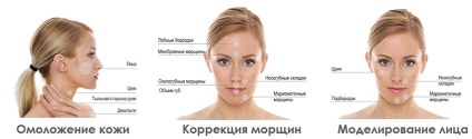 Filery, töltőanyag, féle töltőanyagok (töltés arcon ráncok) Filery, töltőanyag, töltőanyag típusok