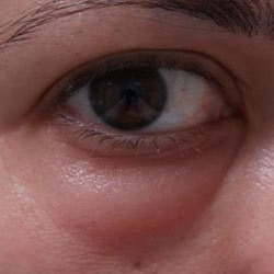 lezeres szem mutet ar image bőrápoló anti aging szérum