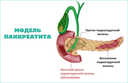 Mi lehet a szövődmények gyomorhurut (het) Mi lehet a szövődmények gyomorhurut