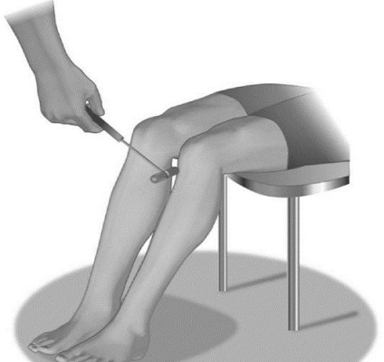 Hogyan okozhat reflexszerűen (veszteség patella reflex) Hogyan okozhat reflexszerűen