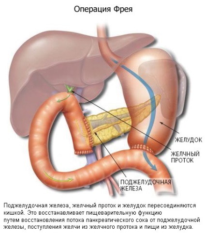 tranzakciók Hasnyálmirigy