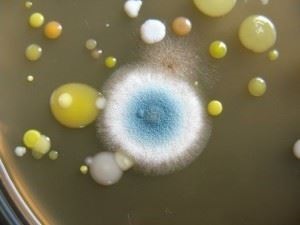 A tápközeg a baktériumok növekedéséhez, és tenyésztést in Microbiology