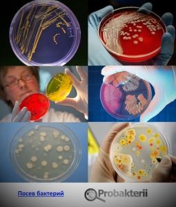 A tápközeg a baktériumok növekedéséhez, és tenyésztést in Microbiology