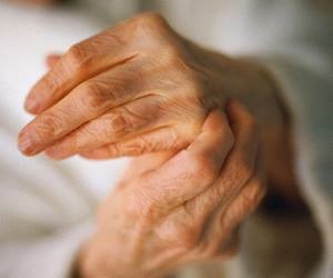 Arthritis ujjaival kéz jeleket, okok, kezelés, videók és fotók