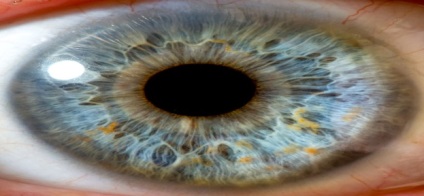 Szaruhártya-homályosodás az emberi szem