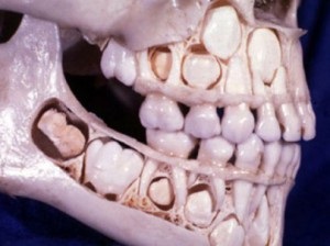 Regeneration fogak - hogyan növekszik az új távoli helyett helyreállítási módszerek