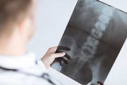 X-ray vagy MRI a gerinc és a szervek, melyik a jobb, a különbség