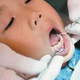 Stomatitis csecsemők (egy tojás) Stomatitis csecsemők