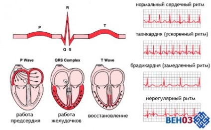 Tachycardia szív, mi az, angina pectoris, bradycardia (tünetek)