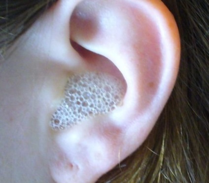 A fül leesik, amikor orrváladék fül