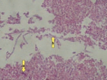 Aspergillosis - észlelésére, megelőzésére és kezelésére, a Baromfi Tenyésztők (takarmány ivóvíz) Aspergillosis - felderítése, megelőzése és kezelése, a baromfitenyésztők