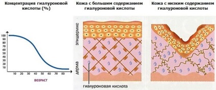Biorevitalization a bőr előnyöket (A hialuronsav a) Biorevitalization bőr előnyök