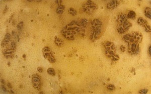 Burgonya betegség fényképet és egy rövid leírást