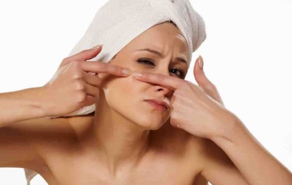 Hogyan akne kezelésére az arcán, hogy gyógyítani bőrt a pattanások és a pattanások