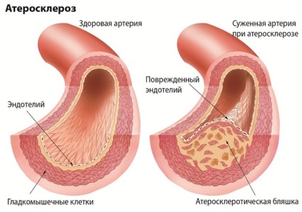 Doppler (Doppler ultrahang) fej és a nyak hajók