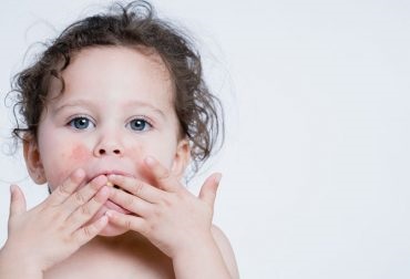 Hatékony kezelés neurodermatitisz gyermekeknél (kezelés) Hatékony kezelés a neurodermitis gyermekeknél