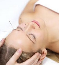Akupunktúra neuritis a facialis