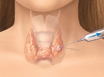 A tanulmány a biopsziás anyag leírása szabványok (kutatás) A tanulmány a biopsziás anyag leírása, szabványok