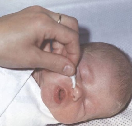Hogyan tisztítható újszülött orra egy hideg